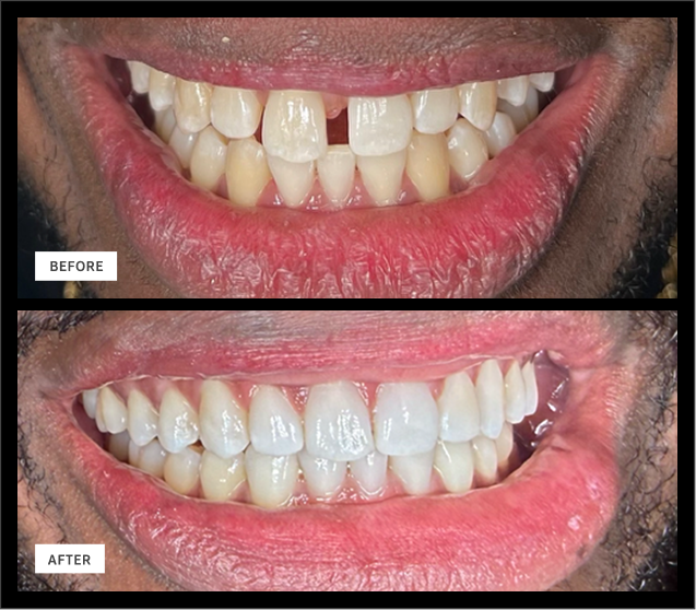 smile Smile Gallery | Woodlands Family Dental